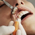 This image shows a person's teeth being cleaned during a dentist appointment.